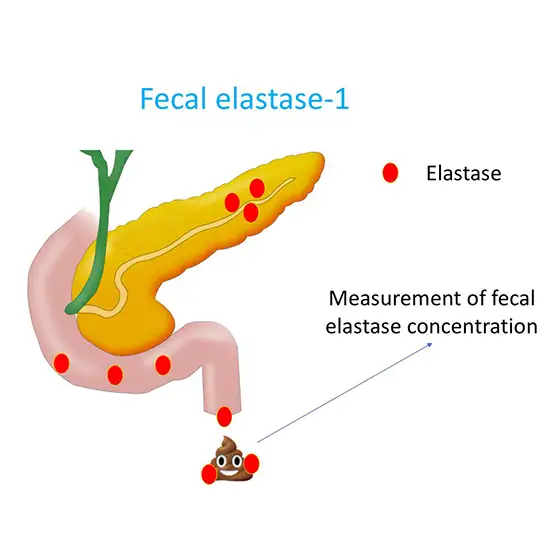 fecal elastase test